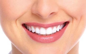 Tooth Whitening In Miami, FL
